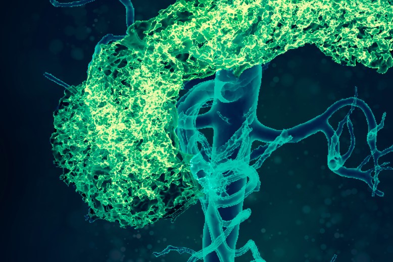 Cardio-metabolic disorders